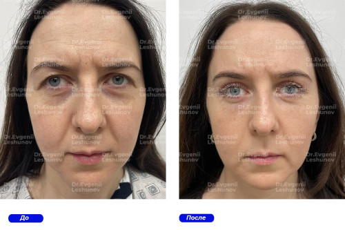 dr-leshunov129b4ac1b9bb3fea.jpg