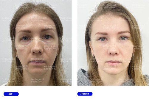 intimateplasty.ru139af821404249c4.jpg